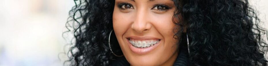 10 benefits of braces