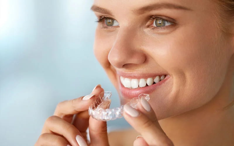 invisalign-in-st-albert
