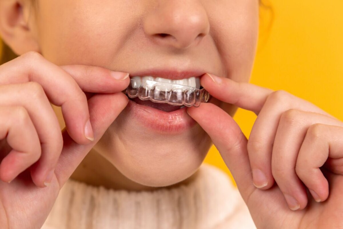 invisalign near you in st albert invisalign near you in st albert