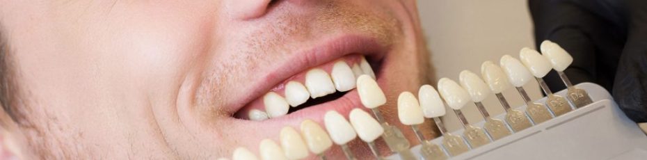 what is the difference between dentures and dental veneers