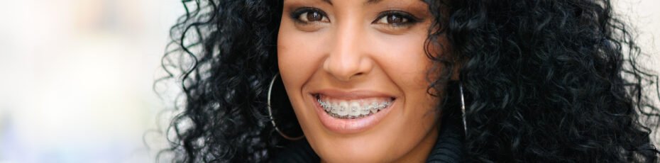 which type of braces are best