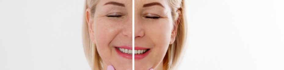 facial exercises do they really work for wrinkle reduction