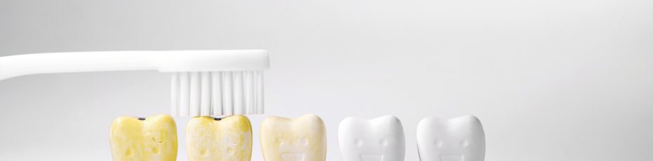 how to prevent and treat tooth discolouration