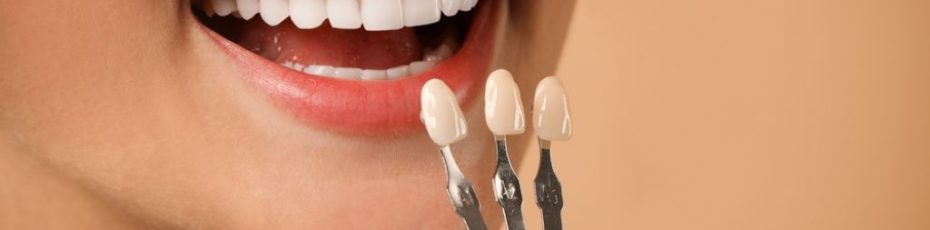 veneers transforming your smile with cosmetic dentistry