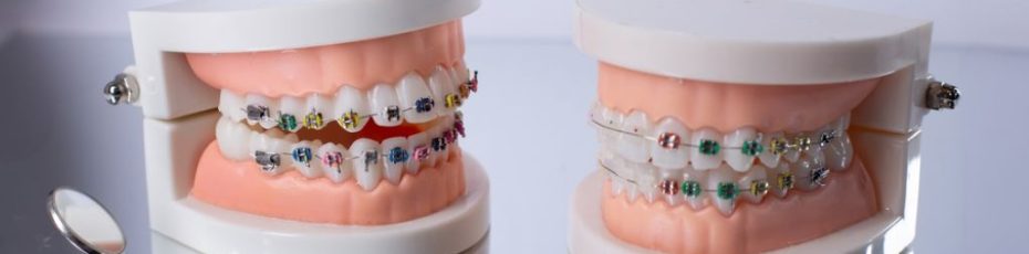 dental care basics simple habits for strong healthy smiles