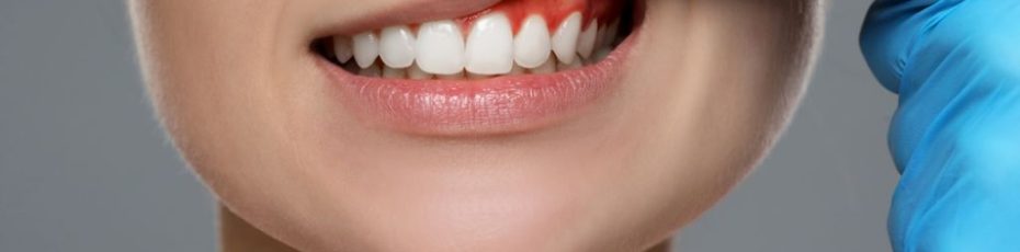 5 simple ways to prevent gum disease