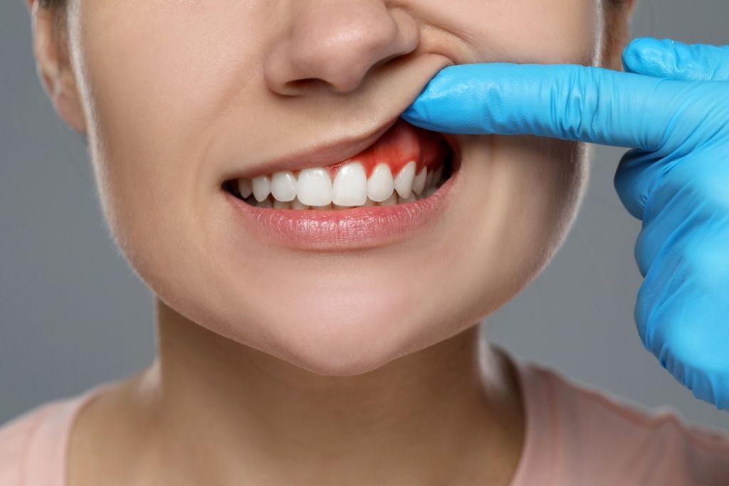 5 simple ways to prevent gum disease