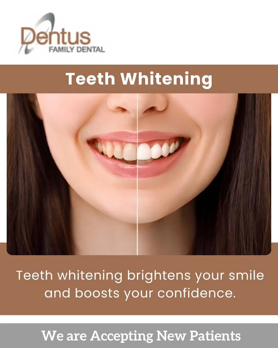 teeth whitening