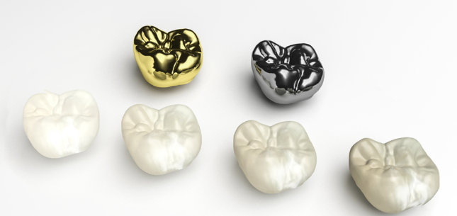 Dental Crowns in St. Albert