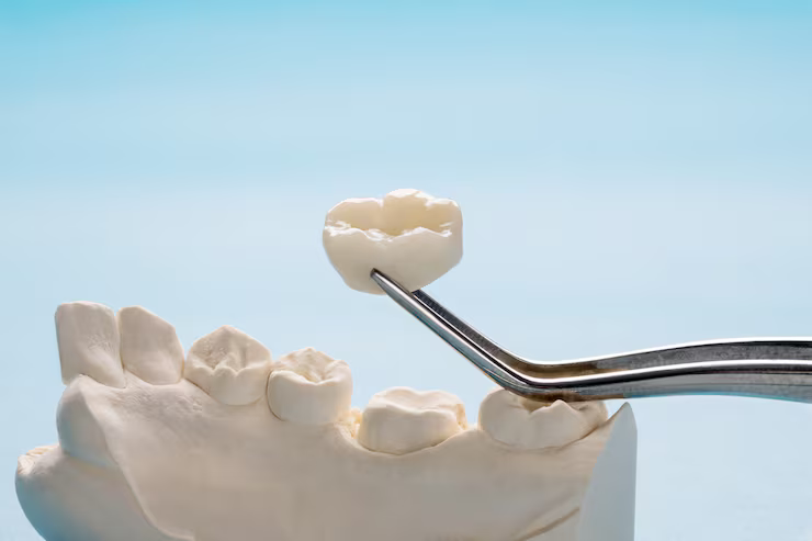 Dental crowns near you
